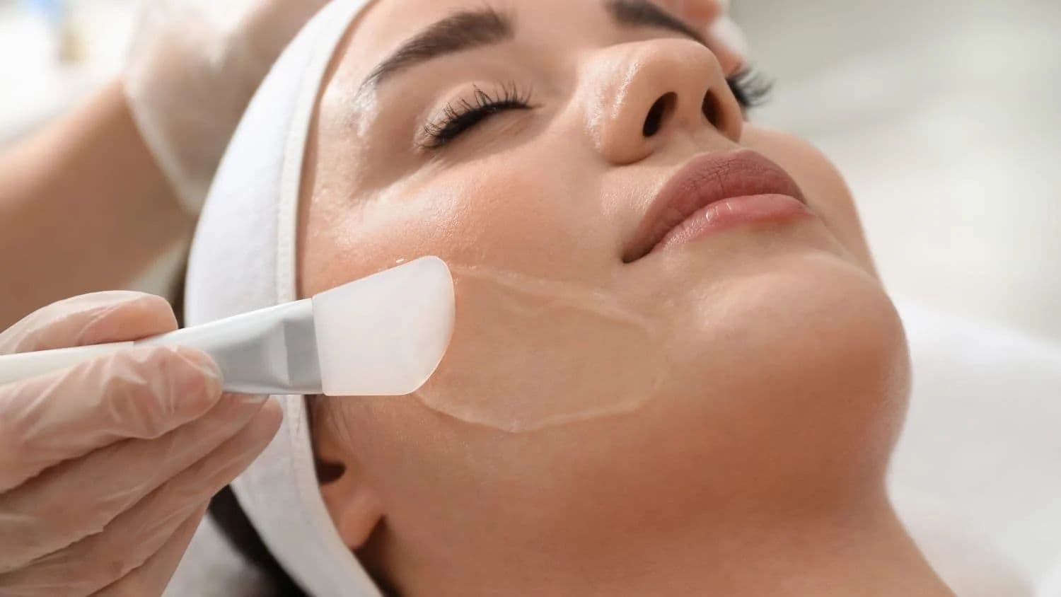 Sylfirm X: Microneedling, RF & Exosomes